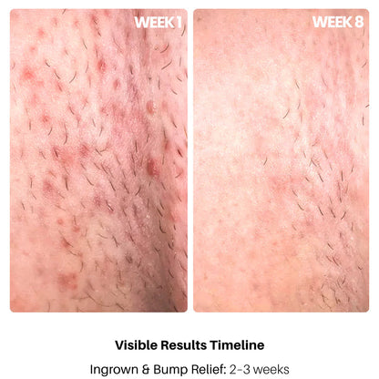 Bright Bikini Line Serum VIP