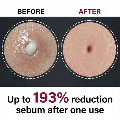 Korean Rice Peel Shot Ampoule Duo VIP